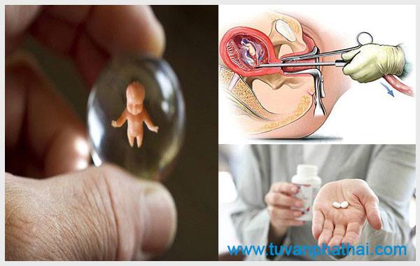 Sảy thai nhanh nhất là dùng thuốc phá thai tại nhà