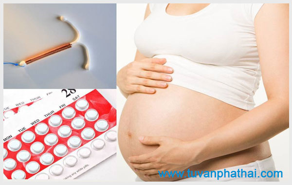 Tháo vòng ngừa thai sẽ giúp bạn mau chóng có bầu trở lại